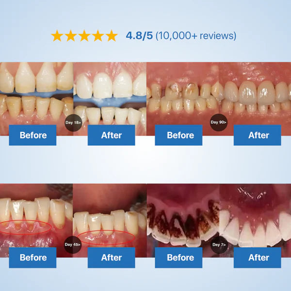 Tooth Repairing Powder