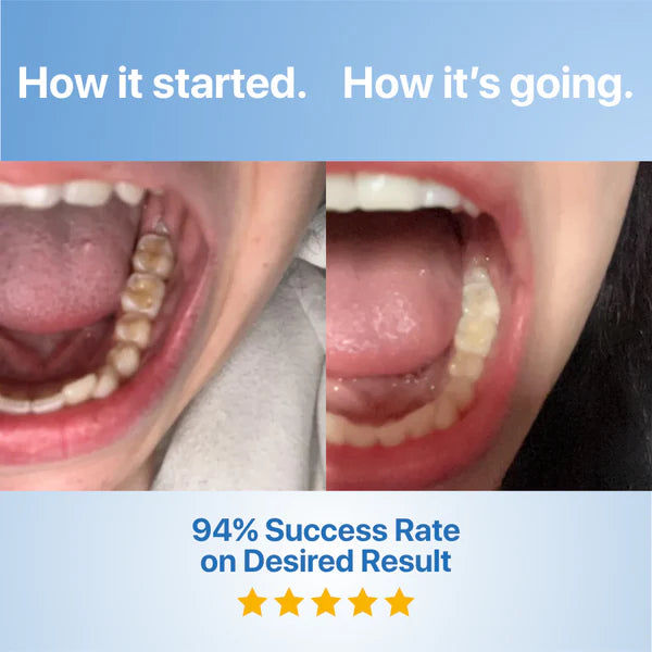 Tooth Repairing Powder